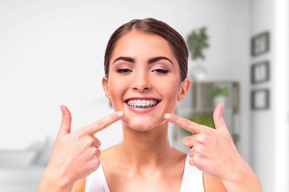 Damon Braces Treatment in Al Nahda