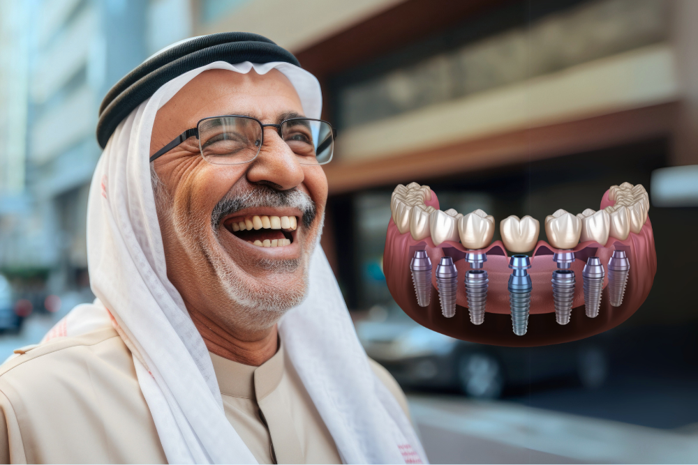 Full Mouth Rehabilitation Treatment in Al Nahda