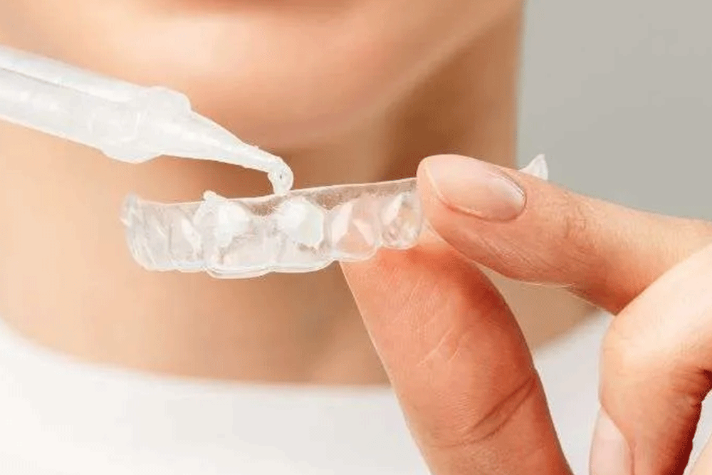 Teeth Whitening