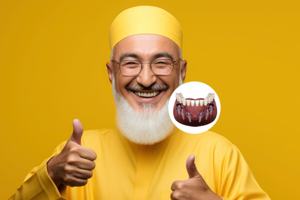 All-on-6 Dental Implant Treatment in Al Nahda