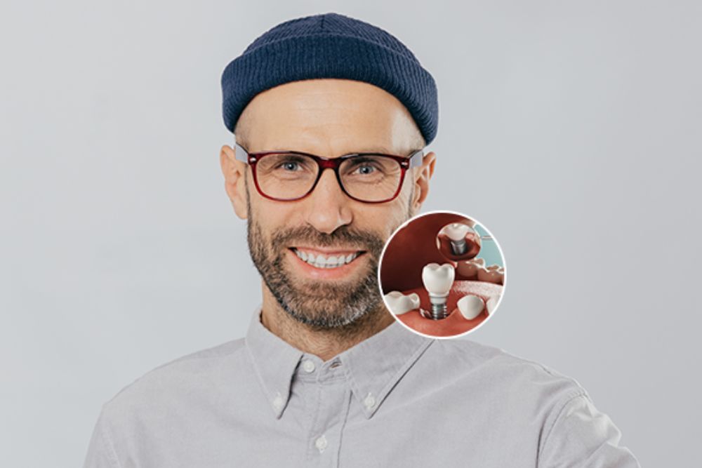 Same Day Dental Implants in Al Nahda